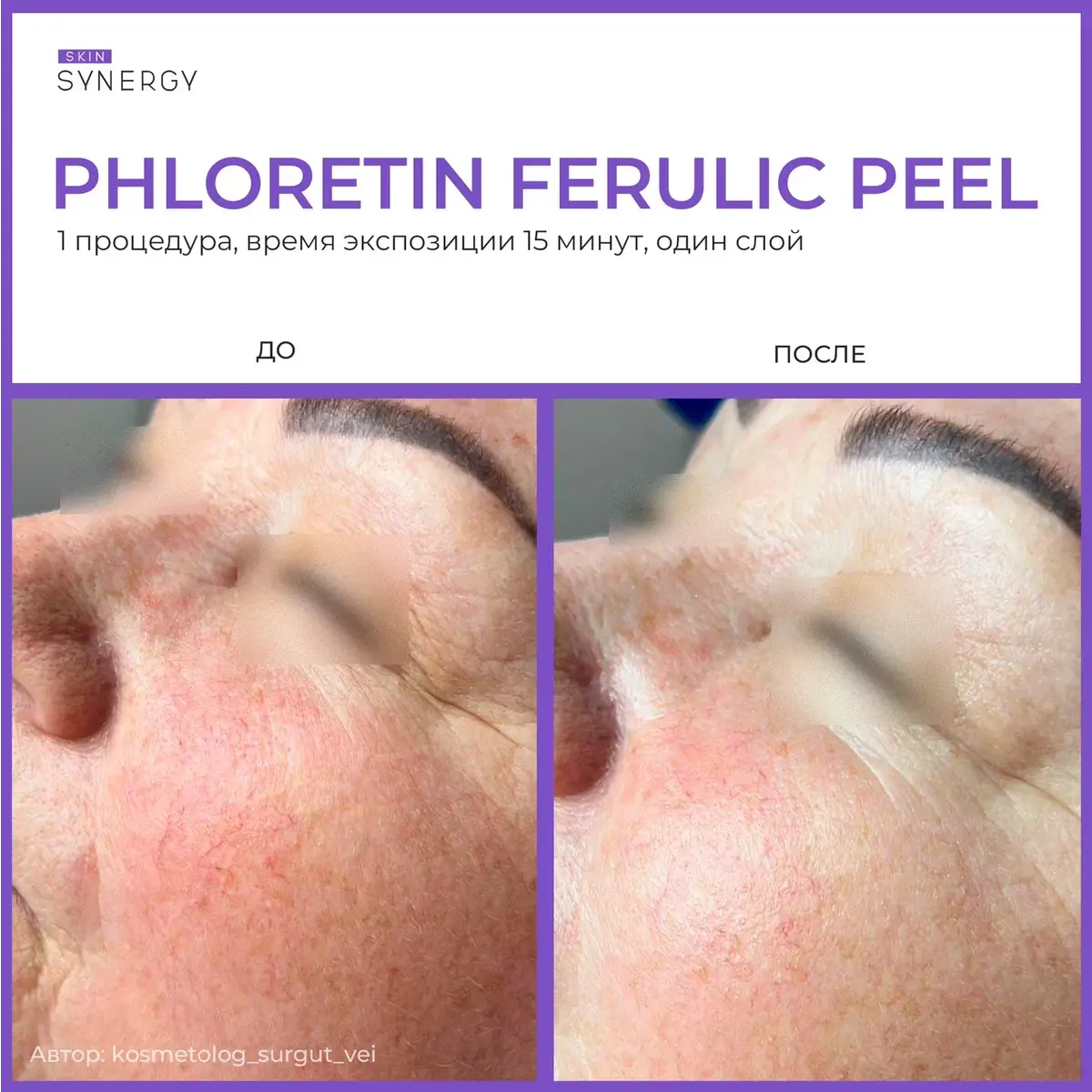 Skin Synergy Пилинг флоретин-феруловый PHLORETIN FERULIC PEEL, 30 мл